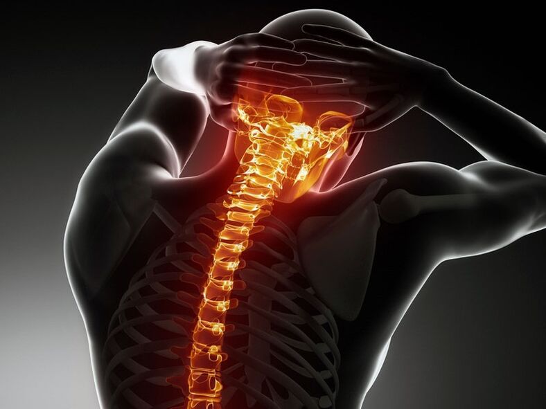 Sintomas de osteocondrose