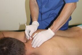 Tratamento passivo de osteocondrose