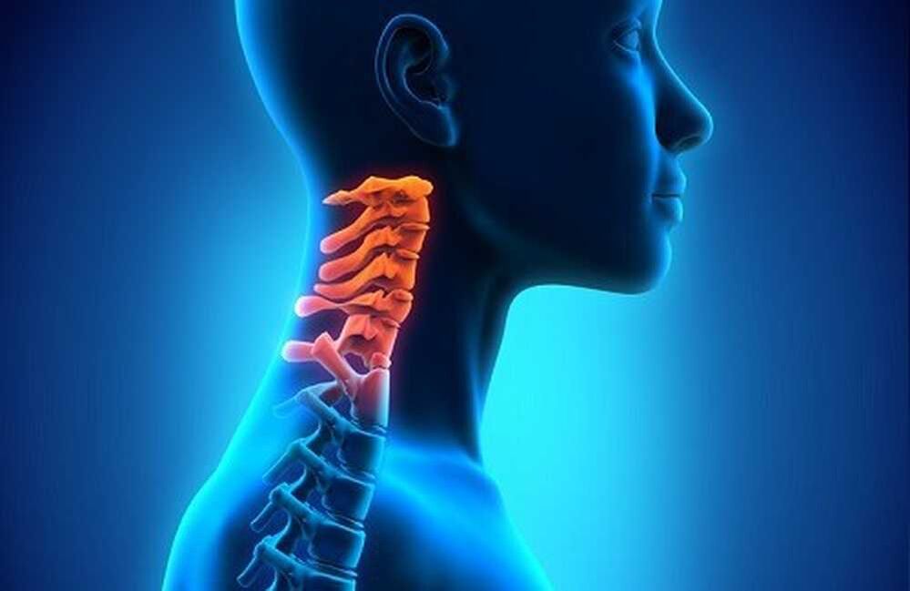 dor na coluna cervical
