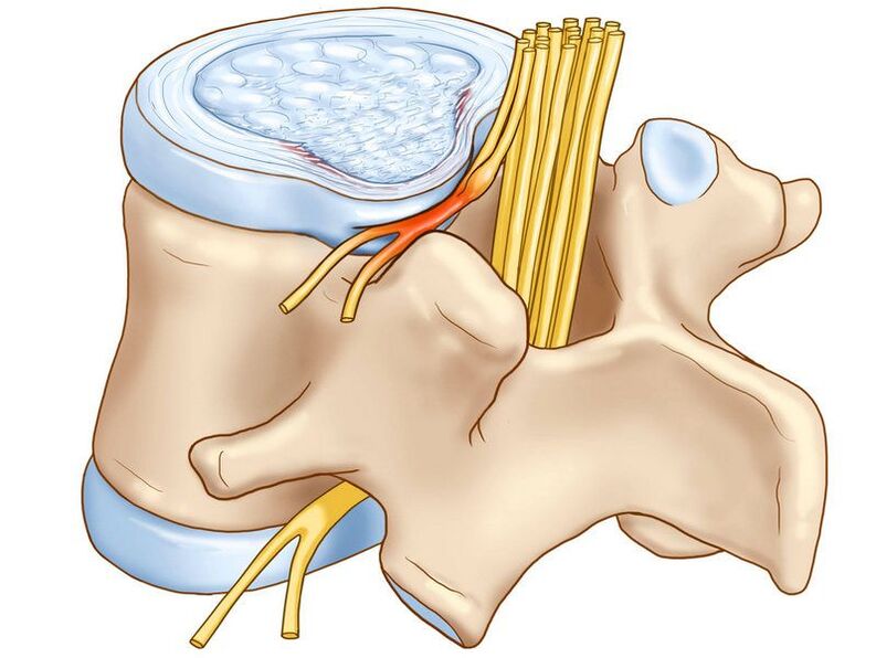 a coluna vertebral é outra causa de possível dor